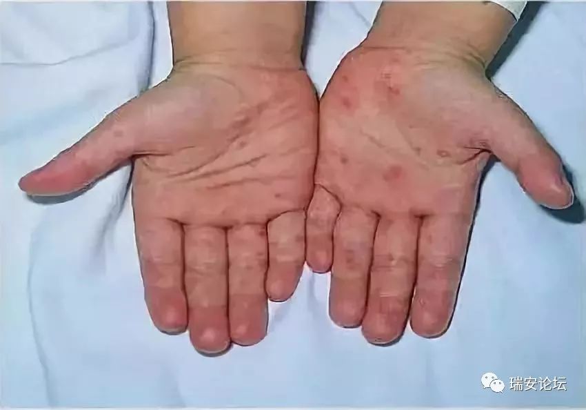 最新病毒死人,最新病毒死人的威胁与全球共同应对,最新病毒威胁与全球共同应对死人危机