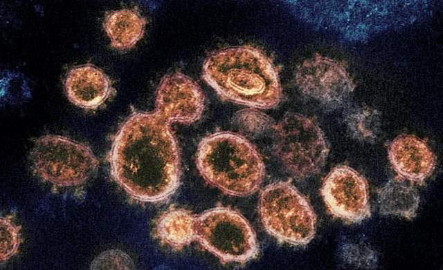 最新出现病毒,最新出现的病毒,人类面临的新挑战,最新病毒出现,人类面临的新挑战